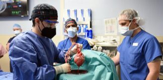 Heart Transplant